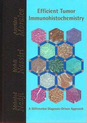 Efficient Tumor Immunohistochemistry - Hardcover, by Mehrdad Nadji - Good