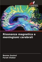 Basma Souissi (U. A.) | Risonanza Magnetica E Meningiomi Cerebrali | Taschenbuch