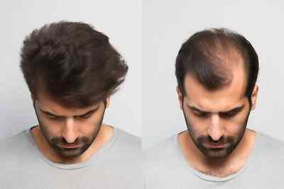 Hair  Length and Thickness Spell