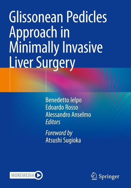 Glissonean Pedicles Approach In Minimally Invasive Liver Surgery Benedetto Ielpo-image