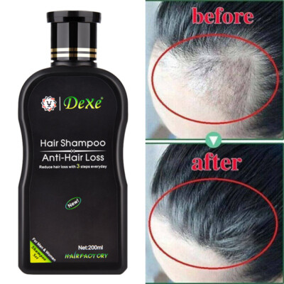 DEXE Hair Growth Shampoo, Anti-Hair Loss Shampoo, Hair Regrowth For Men & Women