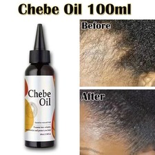 Chebe Hair Growth Oil with Rosemary Oil, Hair Thinning And Hairloss Treatment