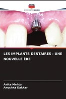 LES Implants Dentaires : UNE Nouvelle ÈRE Anushka Kakkar
