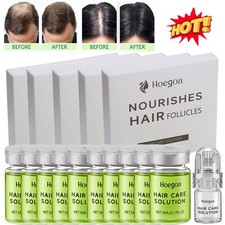 8-40Pcs MICRONEEDLE Hair Regrowth System, Advanced Hair Treatment Ginseng Serum