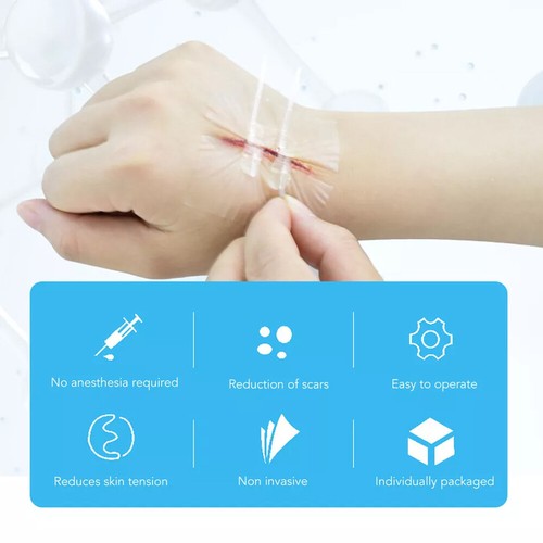 Lot Emergency Wound Closures Surgical Laceration Repair Kit Zip Stitches Aid - Picture 8 of 17