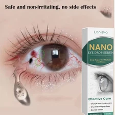 Nano Eye Drops Serum, Natural Nano Lubricant Eye Drops for Dry Eye Presbyopia US