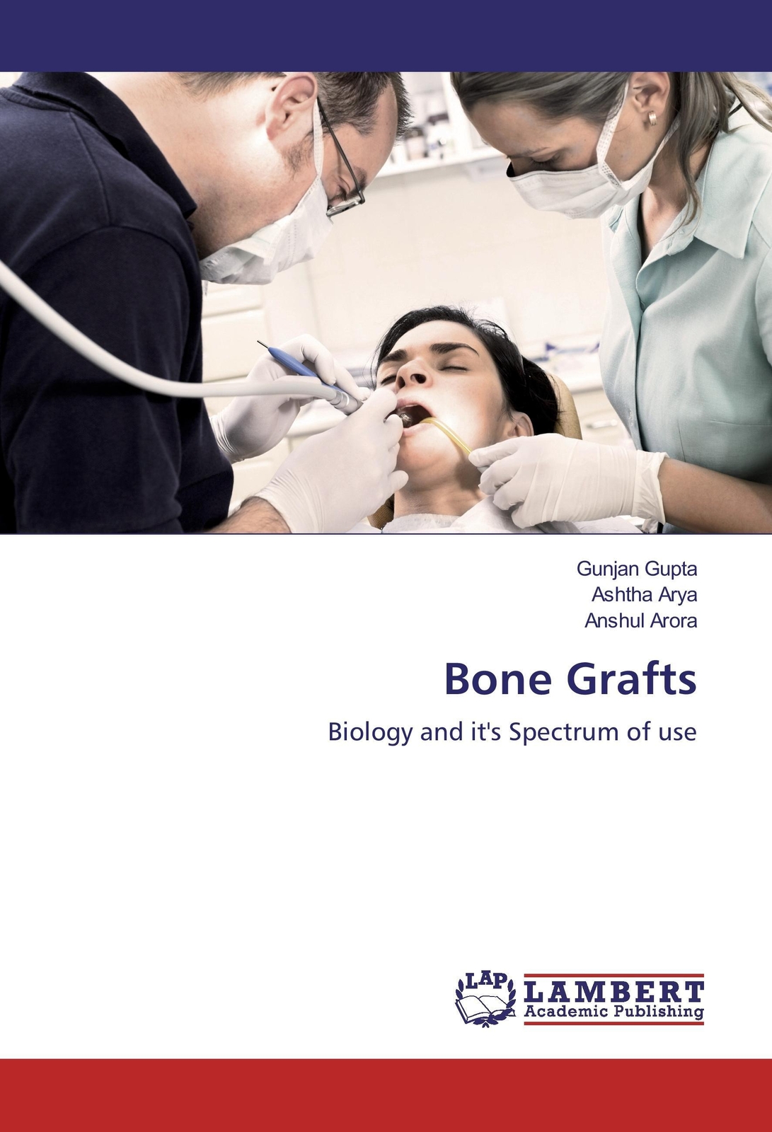 Thumbnail - Gunjan Gupta (u. A.) | Bone Grafts | Taschenbuch | Englisch (2016) |