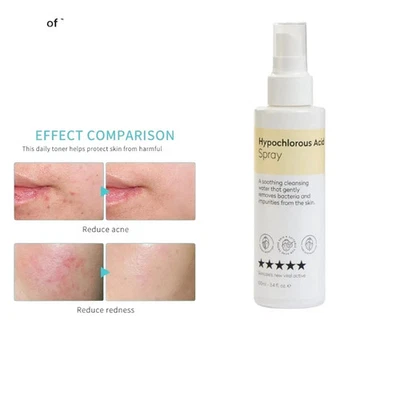 Hypochlorous Acid Spray Redness Reduction For Acne Prone Skin Pore Reduction