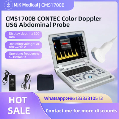 Ultrasound Scanner with CF Color Doppler & Abdominal Probe