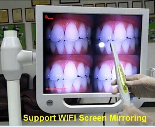 WIFI 17 Zoll High-Definition Digital LCD Monitor Zahn Intra Oral Kamera 5 Mega - Bild 1 von 11
