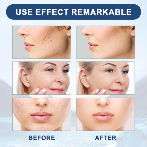 NUEVO, Suero Facial Olavita, Suero Vitamina C y E, Anti Envejecimiento Estiramiento Facial (3 Piezas) - Imagen 4 de 7