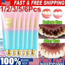 6/3X Niacinamide Whitening Toothpaste - Proven Stain Removal & Fresh Breath 100g