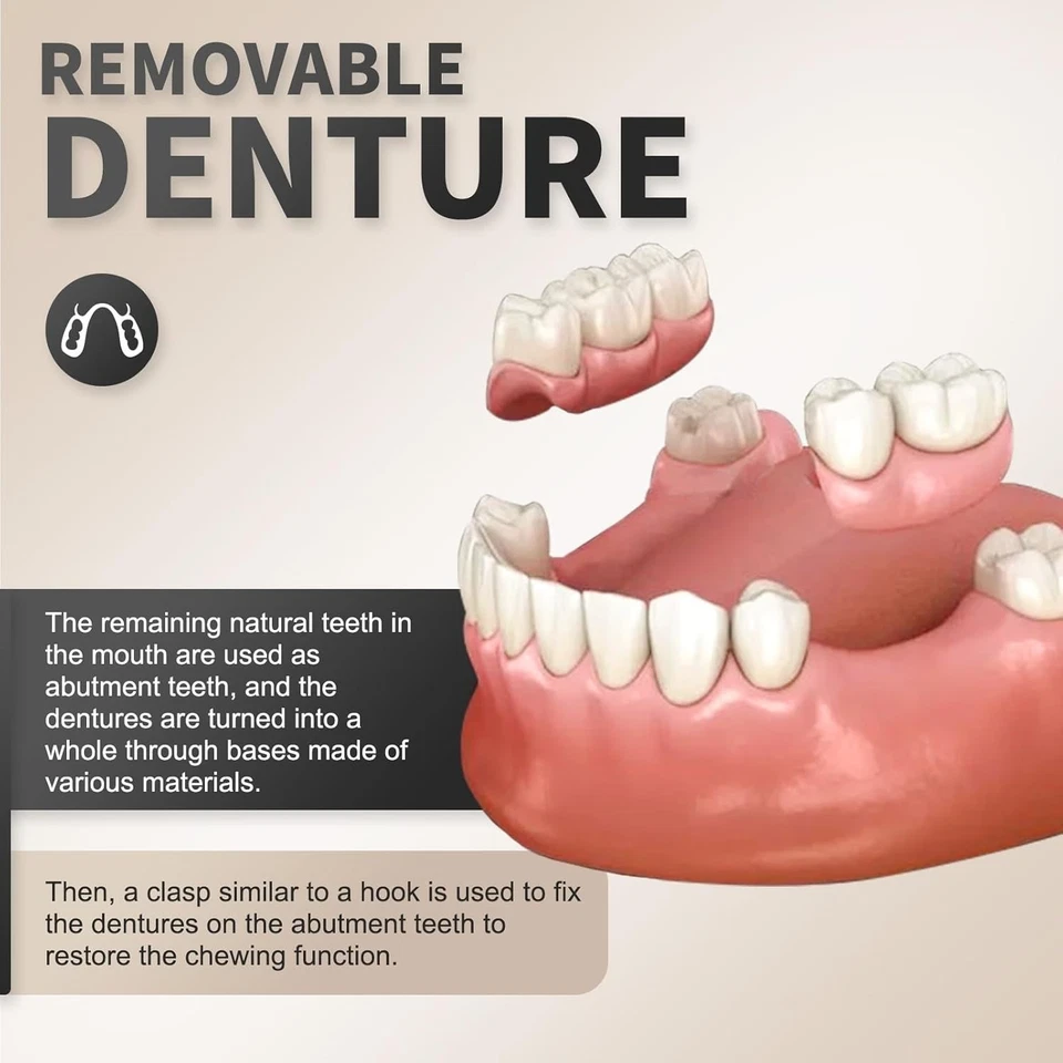 Prótesis dentales removibles de calidad - Elige tu cantidad de dentadura personalizada Foto 4 de 4