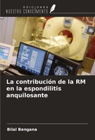 La ContribucióN De La Rm En La Espondilitis Anquilosante Bilal Bengana