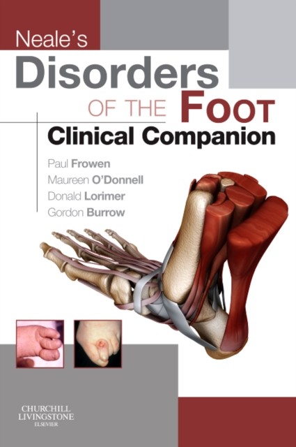 Neale's Disorders of the Foot Clinical Companion,Paul Frowen MPh - Image 5