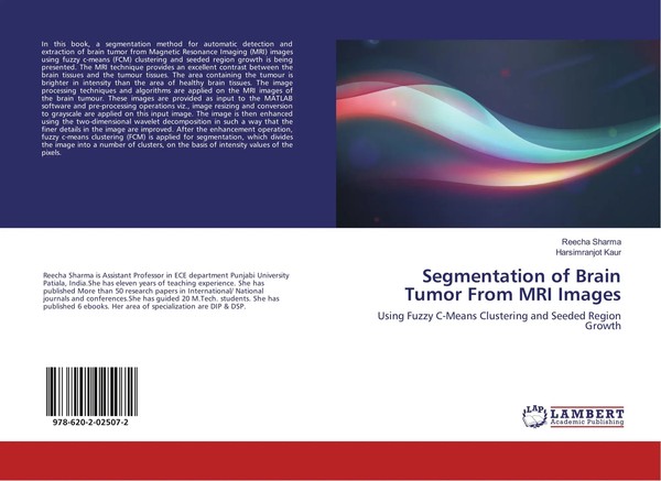 Reecha Sharma (U. A.) | Segmentation Of Brain Tumor From Mri Images | Buch-image
