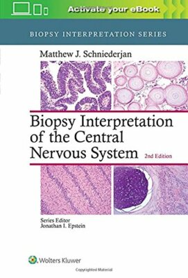 Biopsy Interpretation of the Central Nervous System by Schniederjan New.+