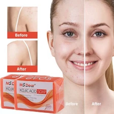 2x Kojic Acid Soap Dark Spot Whitening Moisturizing Skin Bleaching Lightening