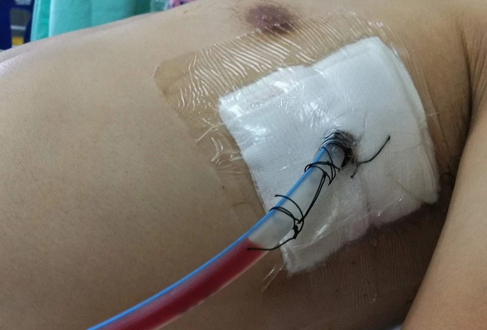 I.V. Esponjas de aderezo divididas de drenaje mezcla de polietileno/rayón 4x4 cuadradas estériles 300ct Foto 4 de 4