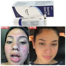 GLYCO 12 Glycolic Acid CREAM 12 Reduce Wrinkles Prevents Acne 30gm  Free Shipp