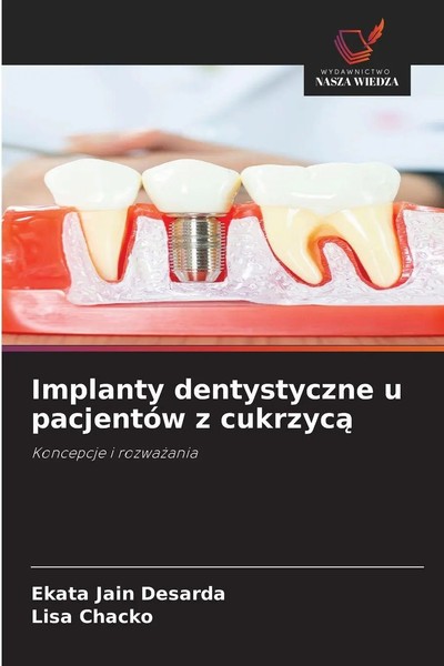 Ekata Jain Desarda (U. A.) | Implanty Dentystyczne U PacjentóW Z Cukrzyc¿ | Buch-image