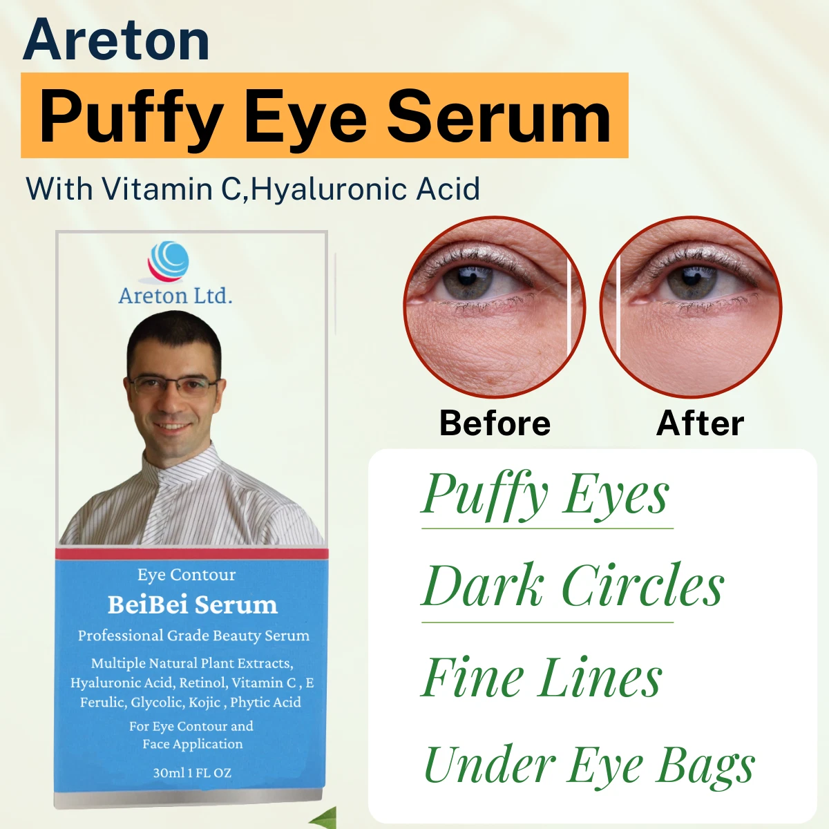 How To Reduce Puffy Eyes