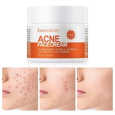 Salicylic Acid Cystic Acne Treatment Moisturizer for Teens Adults, 3.53 OZ