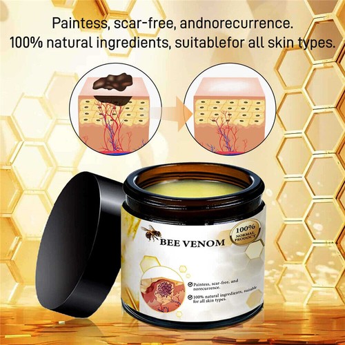 Bee Venom Cream Smooth Skin Remover Spot Repair Wart Treatment Tag Removal Body - Picture 3 of 10