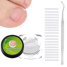 20Pcs Ingrown Toenail Corrector Toe Foot Nail Correction Sticker Pedicure Tool