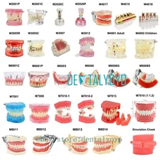Dental Teeth Anatomy Model Orthodontic Implant Typodont Study Caries Training