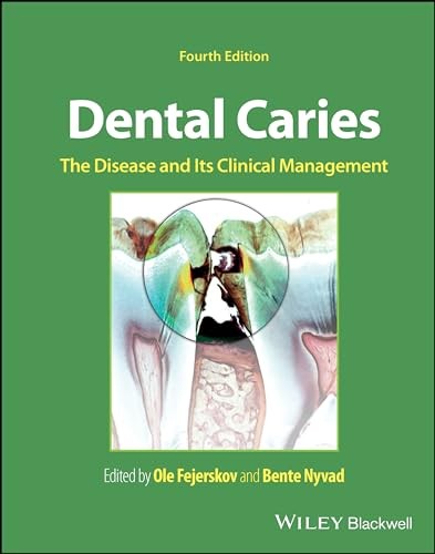 Dental Caries: The Disease and its Clinical Management - Image 4