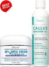 Callus Remover Kit Feet 40 Urea Cream 2 Salicylic Acid - US