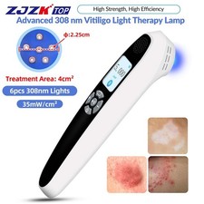 35mW/cm 308nm UVB Therapy Device Handheld Targeted Treatment for Skin Disorders
