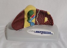 Schering Oncology/Biotech PharmaDesign Liver Anatomical Model Hepatitis Innov.
