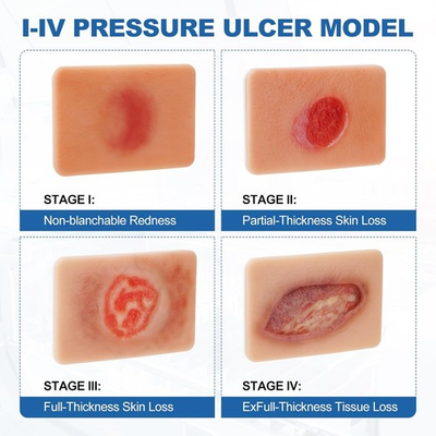 #ad Decubitus Ulcer Wound Care Model Bedsores Model Pressure Injury Model US $119.99
