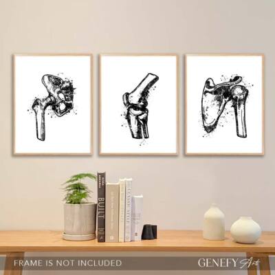 Hüftgelenk, Knie, Schulterknochen schwarz-weiß Aquarelldruck - Knochen Anatomie