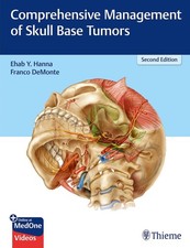 Comprehensive Management of Skull Base Tumors...