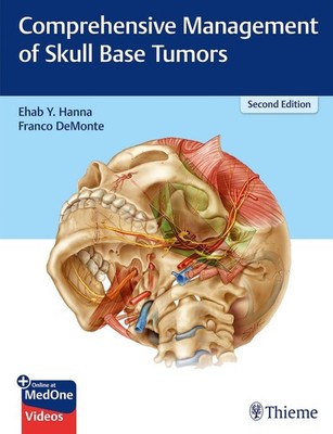 Comprehensive Management of Skull Base Tumors: Plus Online at MedOne Hanna, Ehab