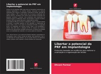 Libertar O Potencial Do Prf Em Implantologia Dhvani Parmar