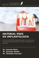 Material Peek EN ImplantologÍA Amruta More (U. A.) Taschenbuch Spanisch 2024
