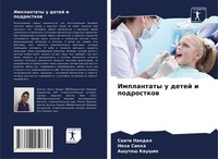 Implantaty U Detej I Podrostkow Swati Nandal