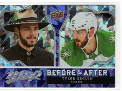 TYLER SEGUIN 2021-22 UPPER DECK MVP BEFORE AND AFTER INSERT #BA3  (ID 2432)