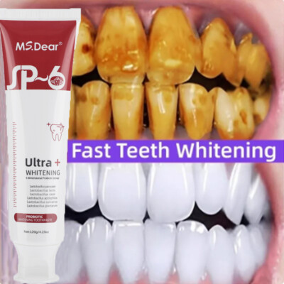 SP-6 Probiotic Whitening Toothpaste Quick White Toothpaste & Keeps Fresh 120g