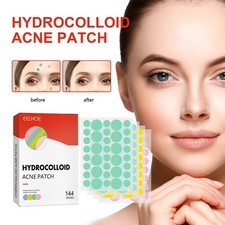 Acne Patch Pimple Spot Treatment Hydrocolloid Colored Blemish Care