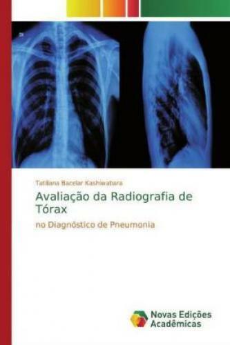 Thumbnail - Avaliação Da Radiografia De Tórax No Diagnóstico De Pneumonia 5471