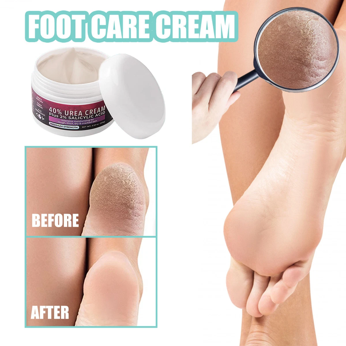 Soften dry deals feet