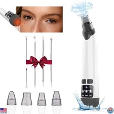 Blackhead Remover Vacuum - Powerful Pore Cleaner with 3 Suction Levels & 4 Tools