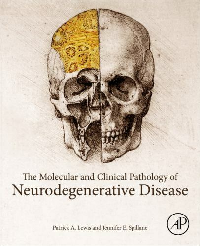 The Molecular and Clinical Pathology of Neurodegenerative Disease Lewis Spillane