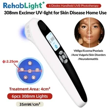 308nm Excimer Ultraviolet Phototherapy Lamp LCD Screen Skin Health Treatments