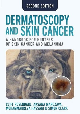 Dermatoscopy and Skin Cancer, second edition by Cliff Rosenda... - 9781914961670